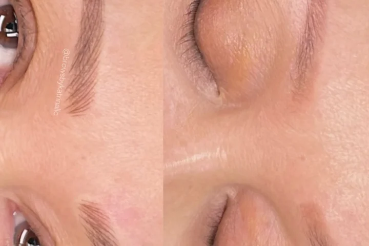 Eyebrow Tattooing