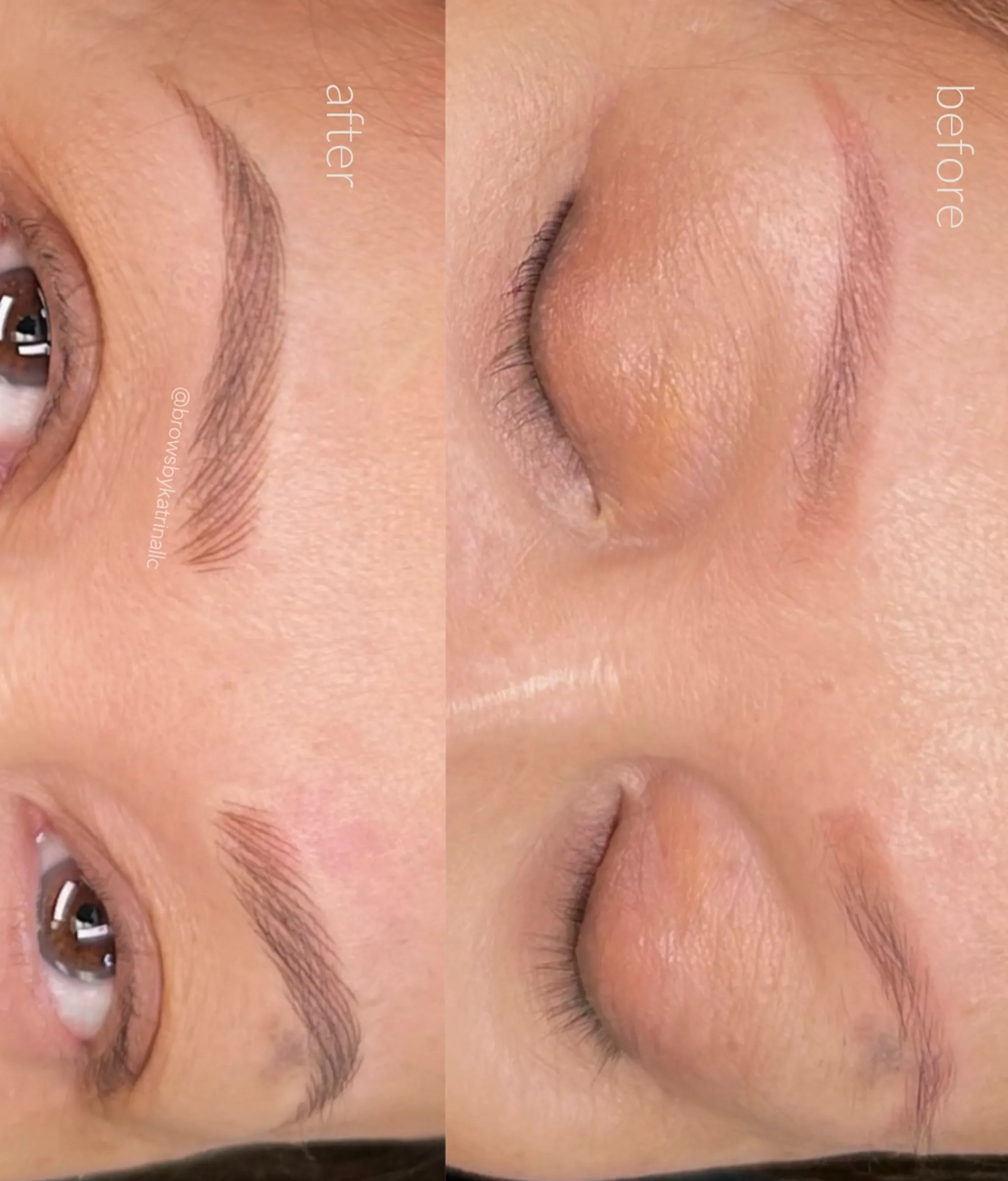 Eyebrow Tattooing
